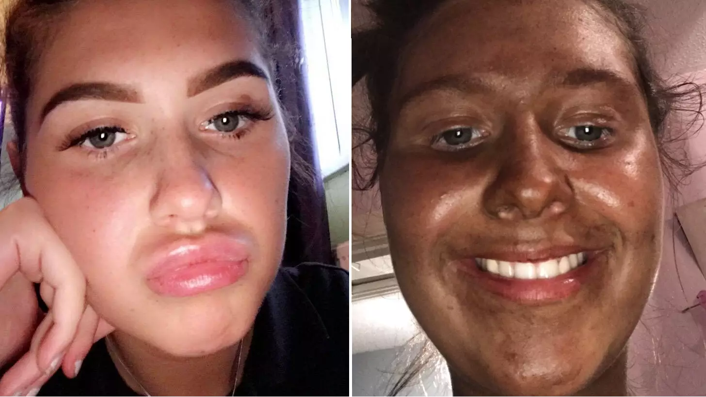 This Woman Left Her Fake Tan On For Too Long And The Results Were Priceless