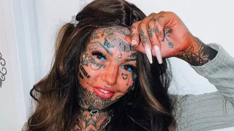 Model Who Tattooed Her Eyeballs Shows Off Results Of Bum Lift 
