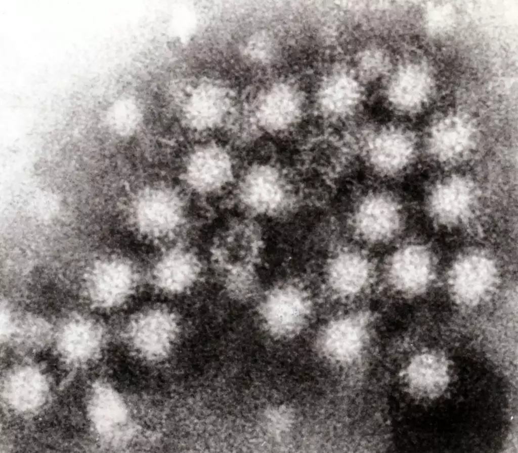 Norovirus particles.