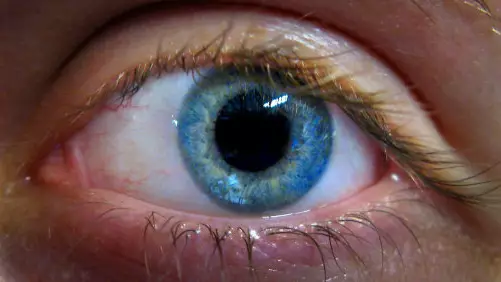 Doctors Get Closer To Curing The UK's Most Common Form Of Blindness