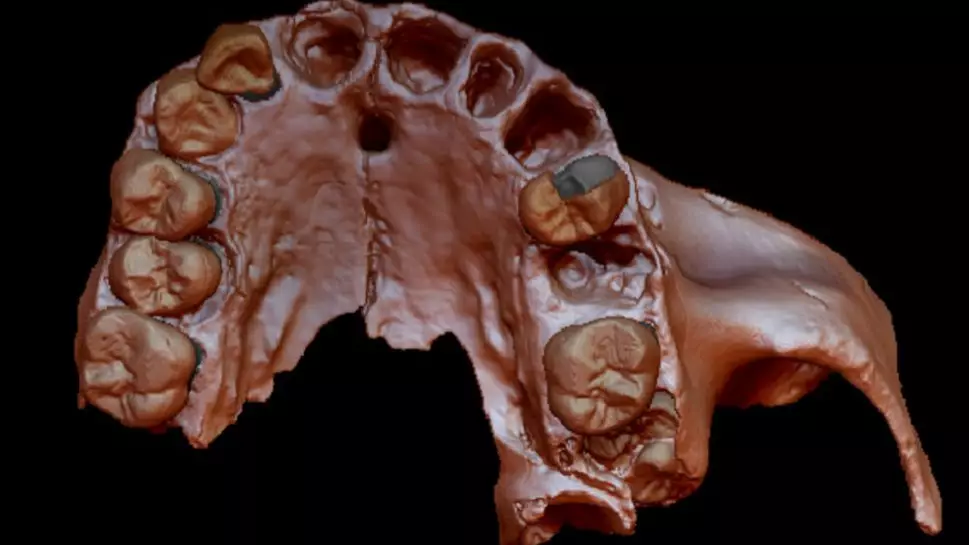 ​Scientists Find World’s Oldest DNA In Tooth Of 800,000-Year-Old Cannibal