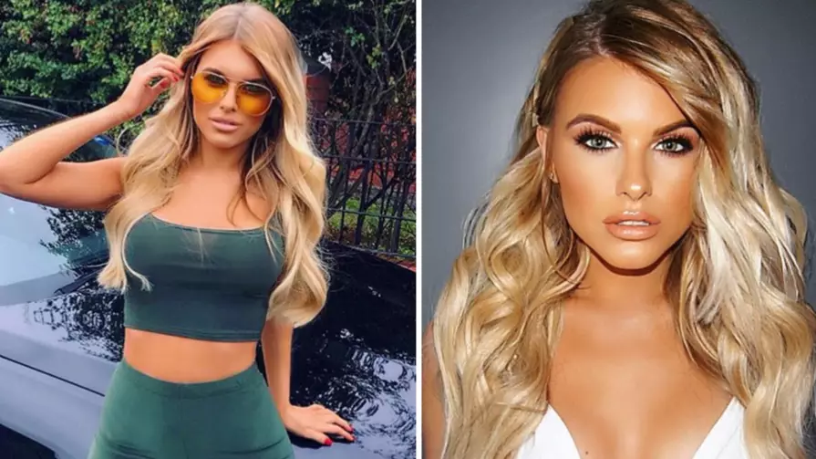 ​Love Island’s Hayley Hughes Shocks Fans With New Hairstyle