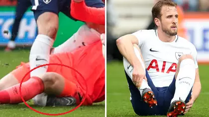 Spurs Confirm Harry Kane Injury, It's Bad News For Club And Country