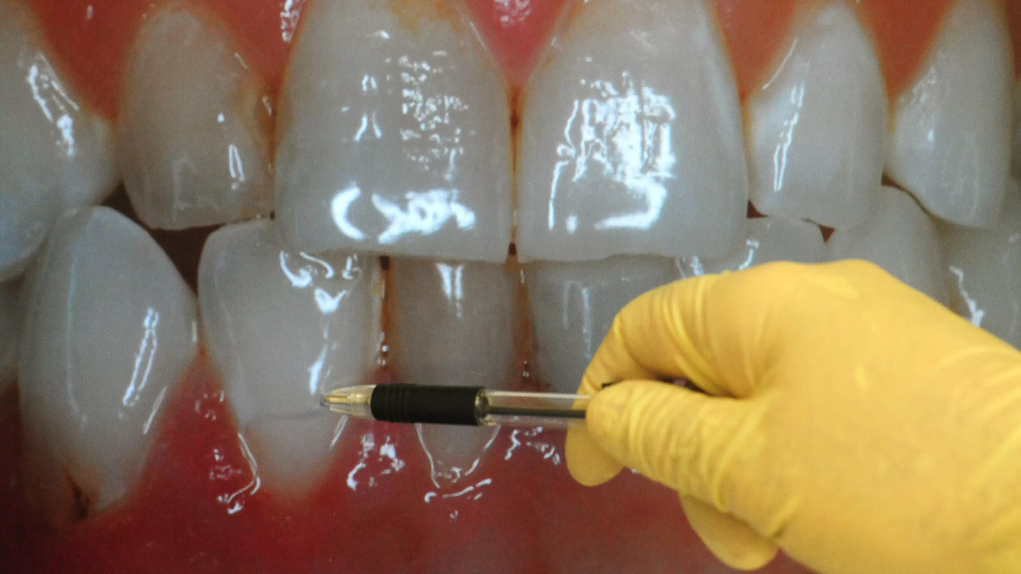 Top Dentist Reveals Common Bad Habits That Could Be Damaging Your Teeth