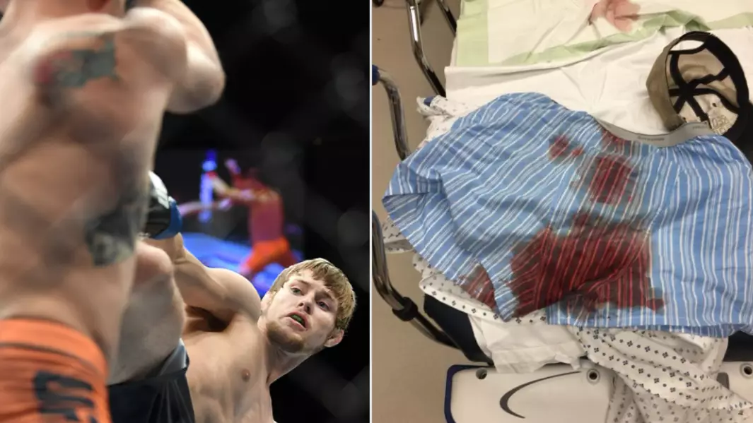 UFC Star Bryce MItchell Tears His Scrotum 'In Half' In Horrific Accident 