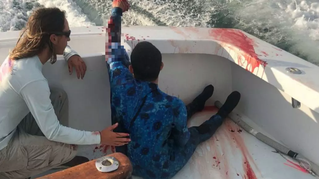 Man Bitten By Shark Saved By Boat Full Of Nurses Passing By