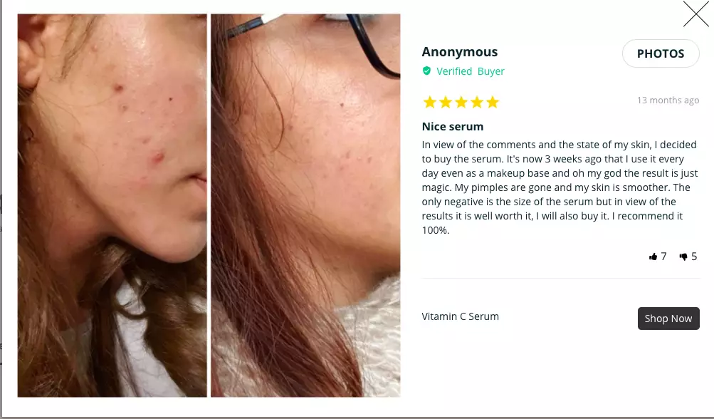 Another claimed her acne was gone in several days. (