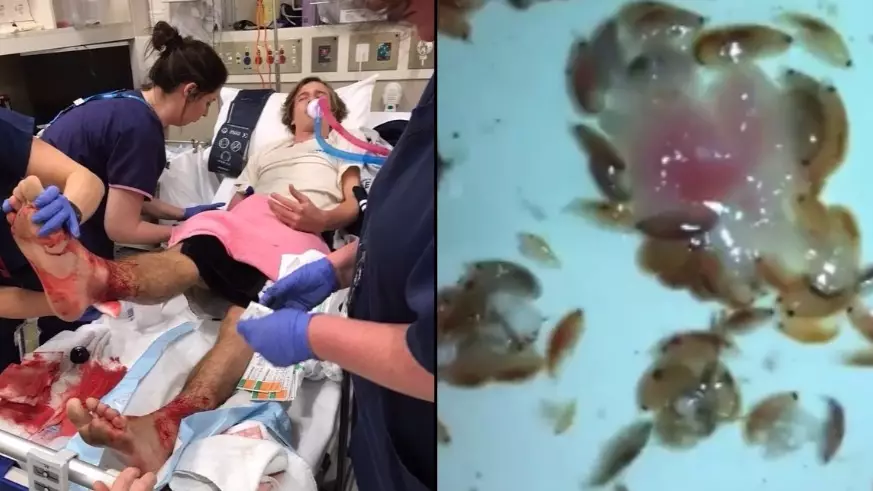 Australian Teen's Feet Won't Stop Bleeding After Being 'Eaten' By Sea Bugs 