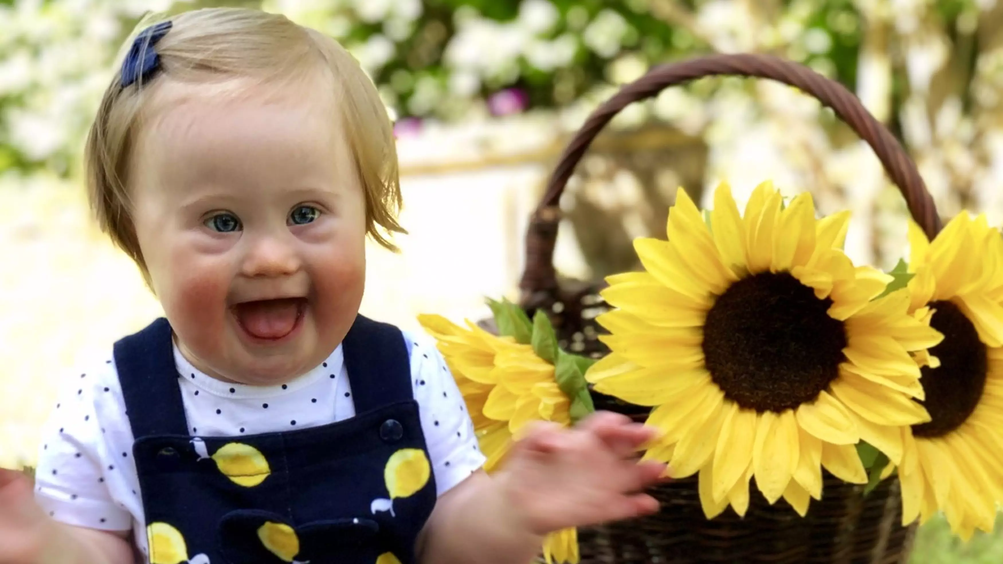 Toddler With Down's Syndrome Becomes Face Of Children's Fashion Campaign