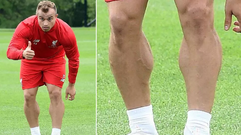 Xherdan Shaqiri's Legs Have A Bigger Future Than Everton 