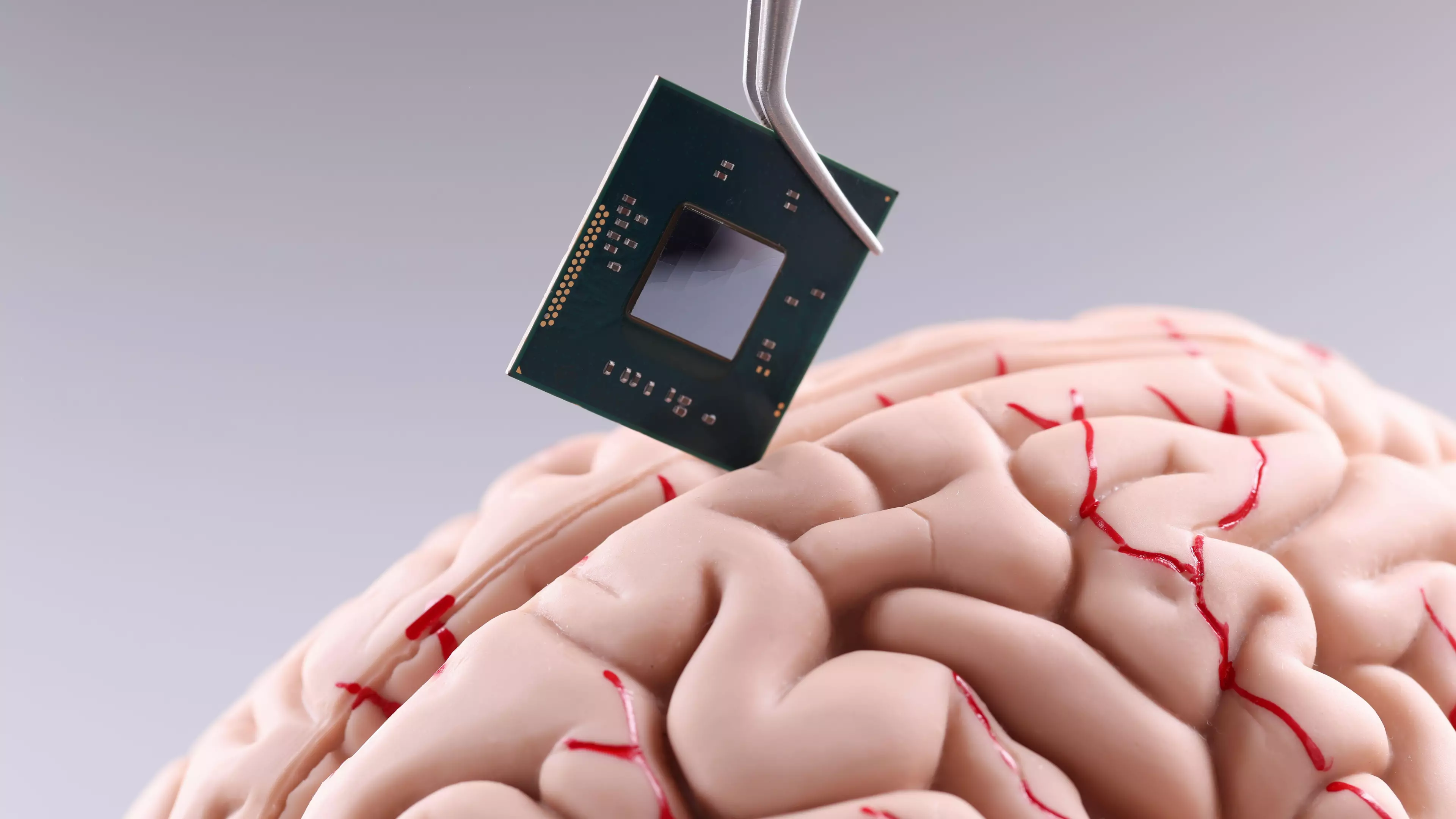 Scientists Are Deeply Worried About Elon Musk’s Brain Chip Neuralink 