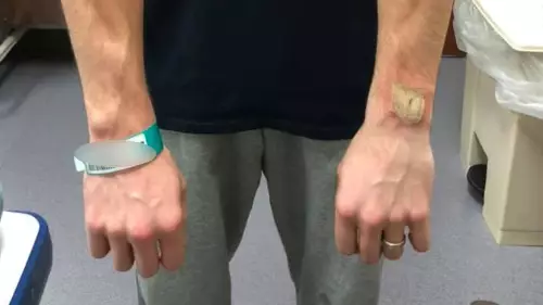 Man Claims He Was Left With Nasty Burn After Fitbit Started 'Burning And Smoking' 