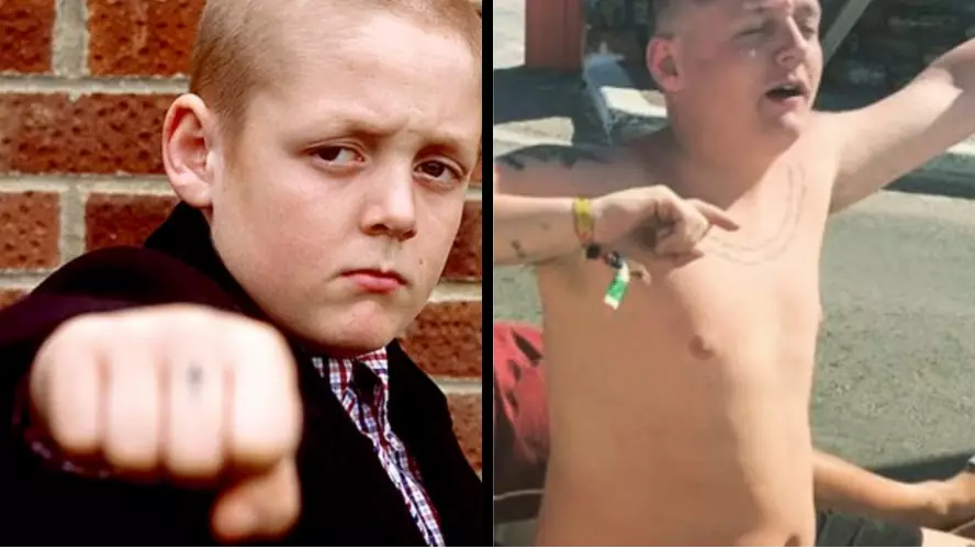 ‘This Is England’ Star Thomas Turgoose Reveals Incredible Transformation