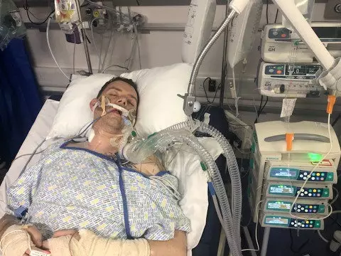 Chris Mallon was in a coma for 10 days after the fall on his wedding night.