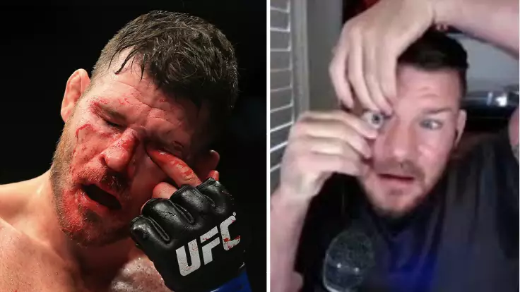 Former UFC Champion Michael Bisping Pops Out Prosthetic Eye During Podcast 
