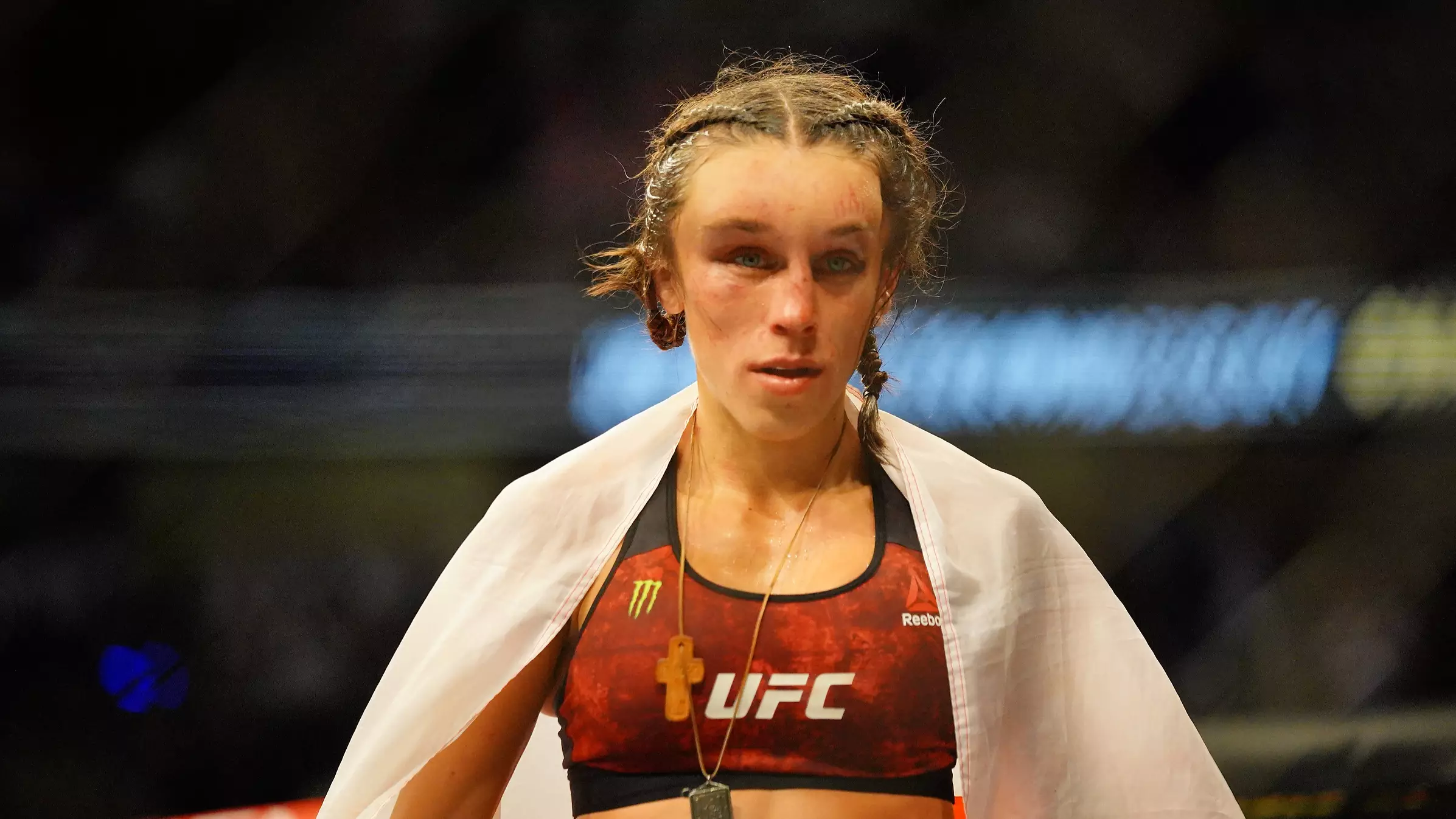 Joanna Jedrzejczyk Shows Off Her Badly Bruised Face In Video 