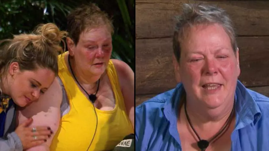 I'm A Celebrity: Anne Hegerty Reveals Why She Was Let Off From So Many Trials