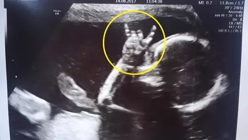 Tot Let Dad Know She Shared His Love Of Music With 'Devil Horns' Sign In Pregnancy Scan