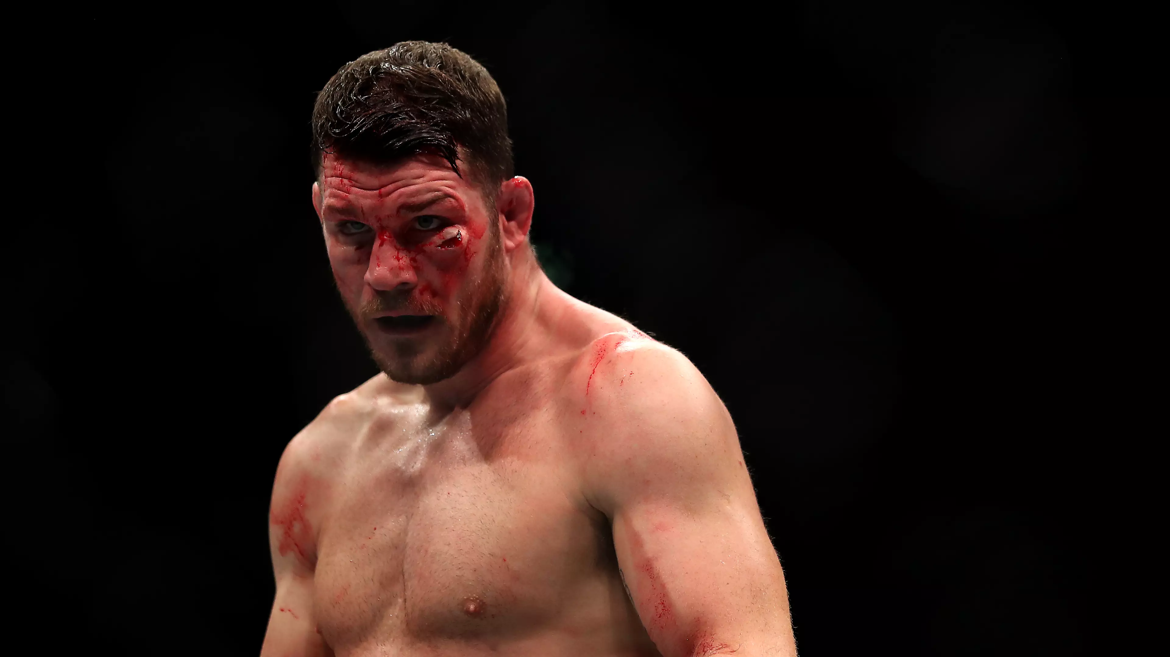 Michael Bisping 'Laughed And Walked Off' After Being Assaulted In The Street