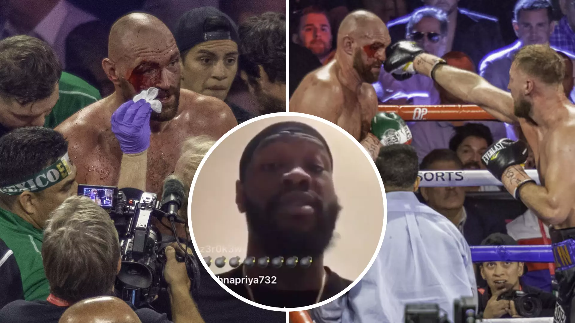 Deontay Wilder Hints At New Theory Over Rumours That Tyson Fury's Cut Reopened