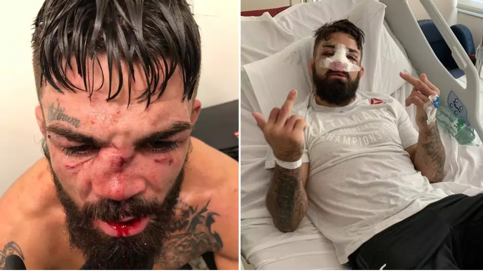 Mike Perry Shares Epic Message From His Hospital Bed After Undergoing Nose Surgery