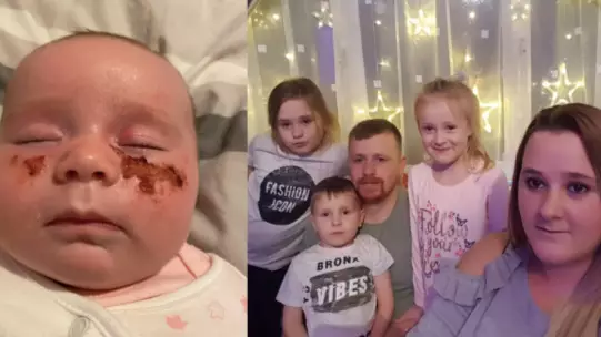 Mum Issues Warning After Plant Burns Baby's Skin