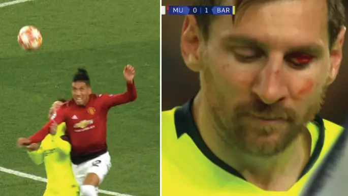 Chris Smalling Cleans Out Lionel Messi, Leaving Him Full Of Blood