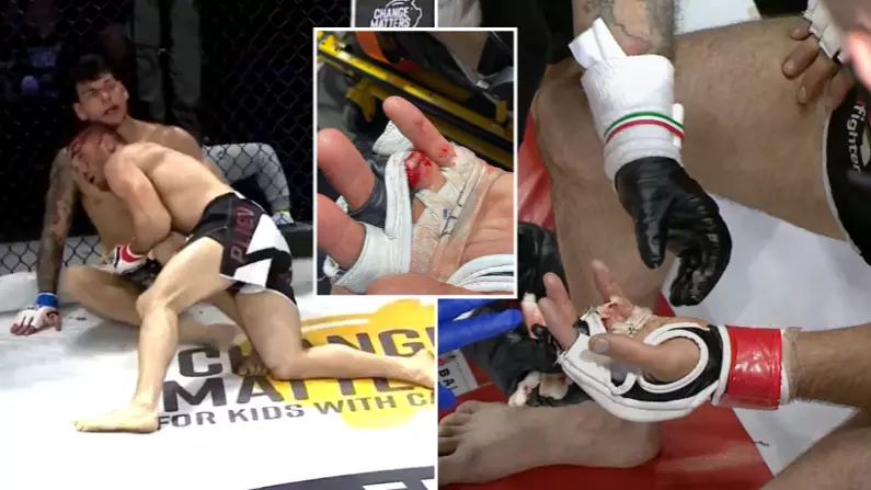 Khetag Pliev Loses His Finger During CFFC 94 Fight With Devin Goodale