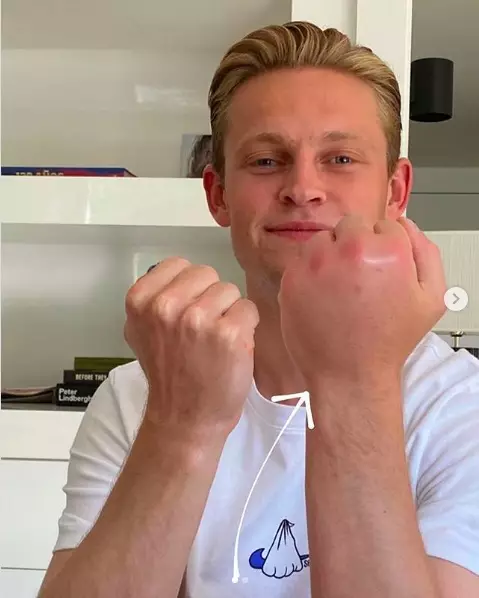 De Jong showing off his injury. Image: Instagram 