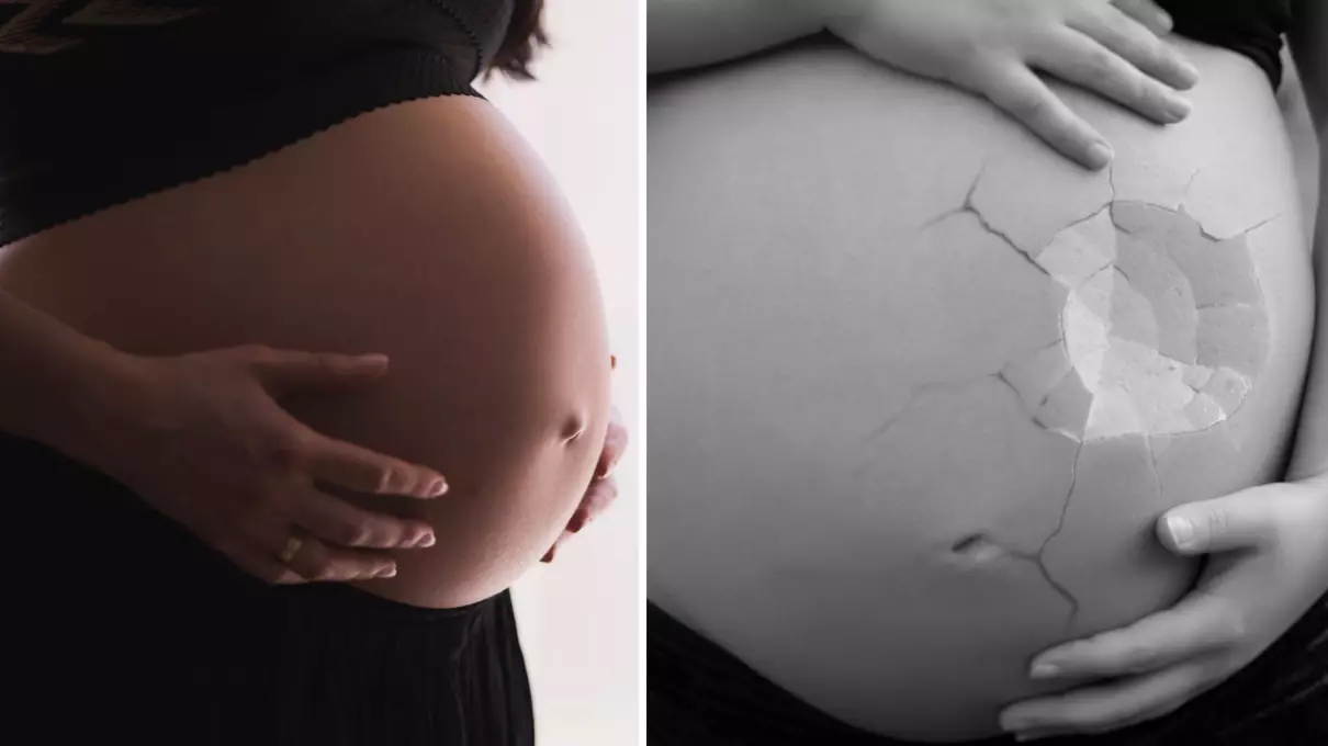Pregnant Woman Nearly Died After Baby Kicked A Hole In Her Womb