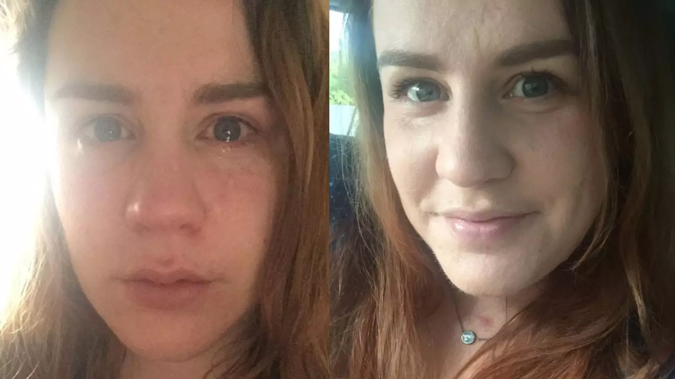 Woman Shares Powerful Image After Reading Story About People 'Faking Mental Illness'