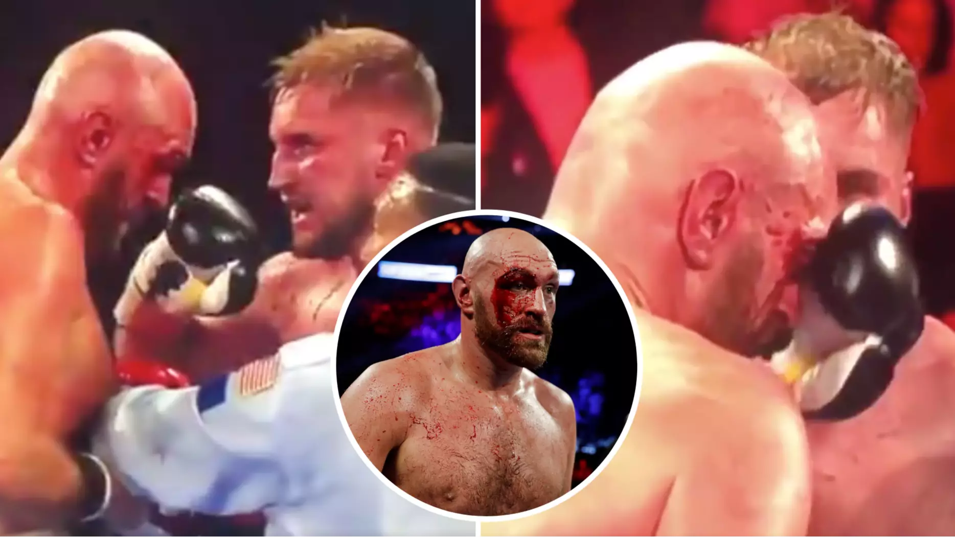Tyson Fury's Clash With Deontay Wilder In February Could Be Postponed Because Of Gypsy King's Deep Cuts
