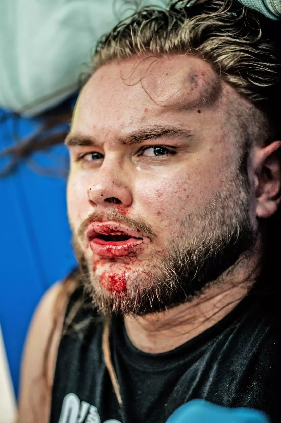 Danny says he and his band of misfits put their lives on the line for the sport, and they have the scars to prove it.