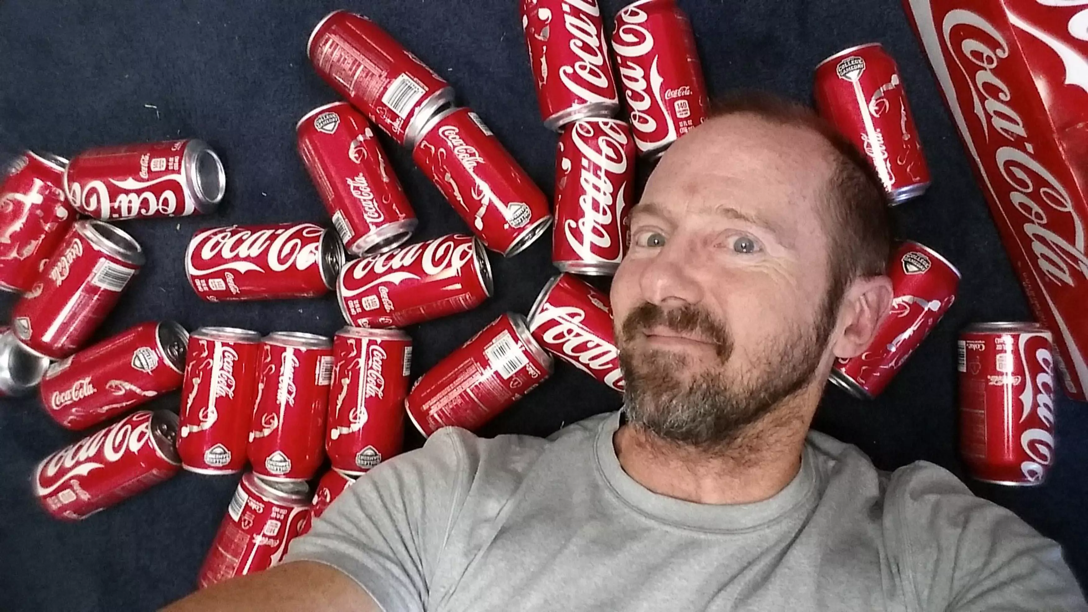 Guy Decides To Drink 10 Cokes A Day To See The Results