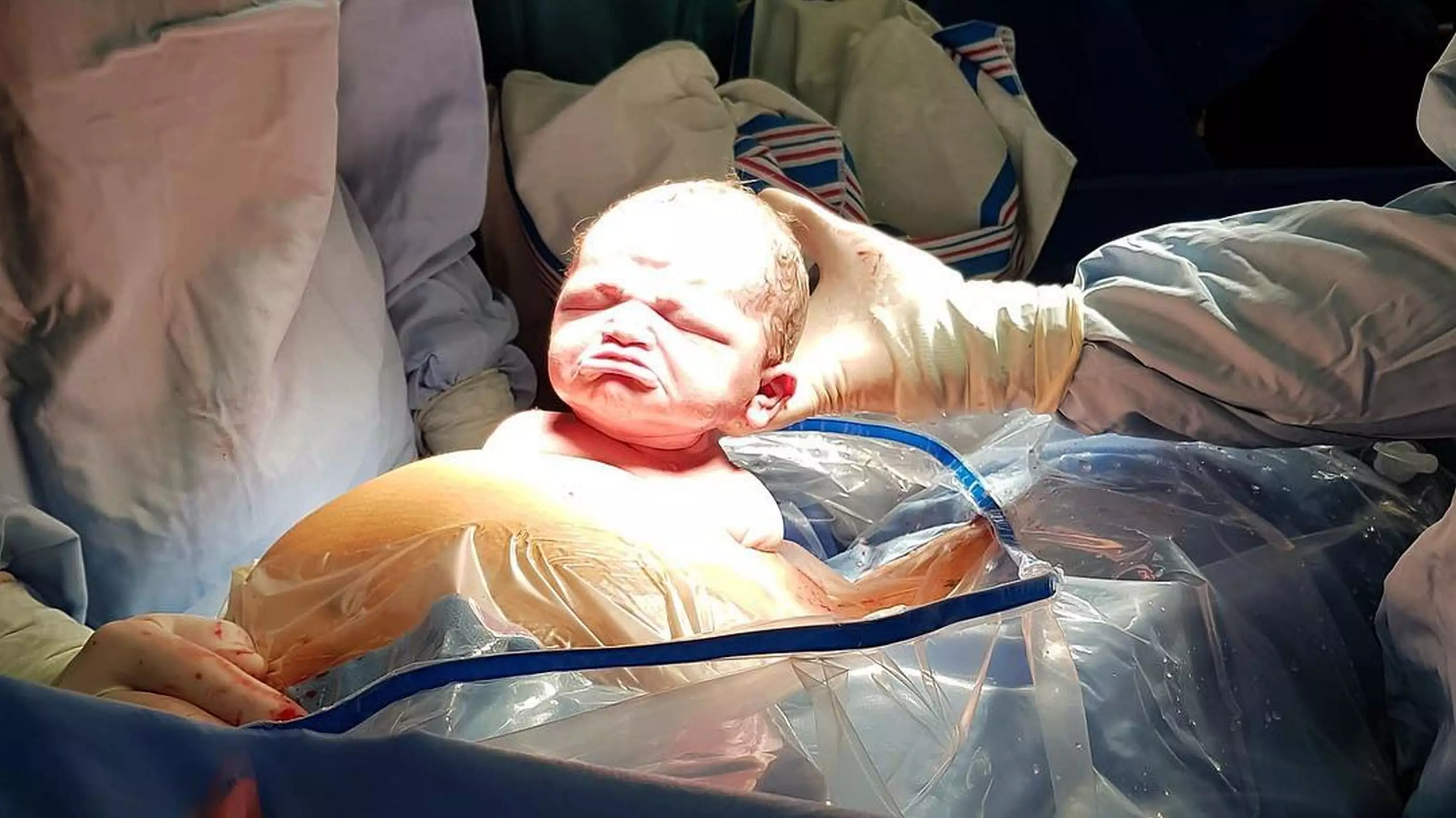 Photo Shows Baby Emerging From The Womb With Hilarious Scowl On Her Face