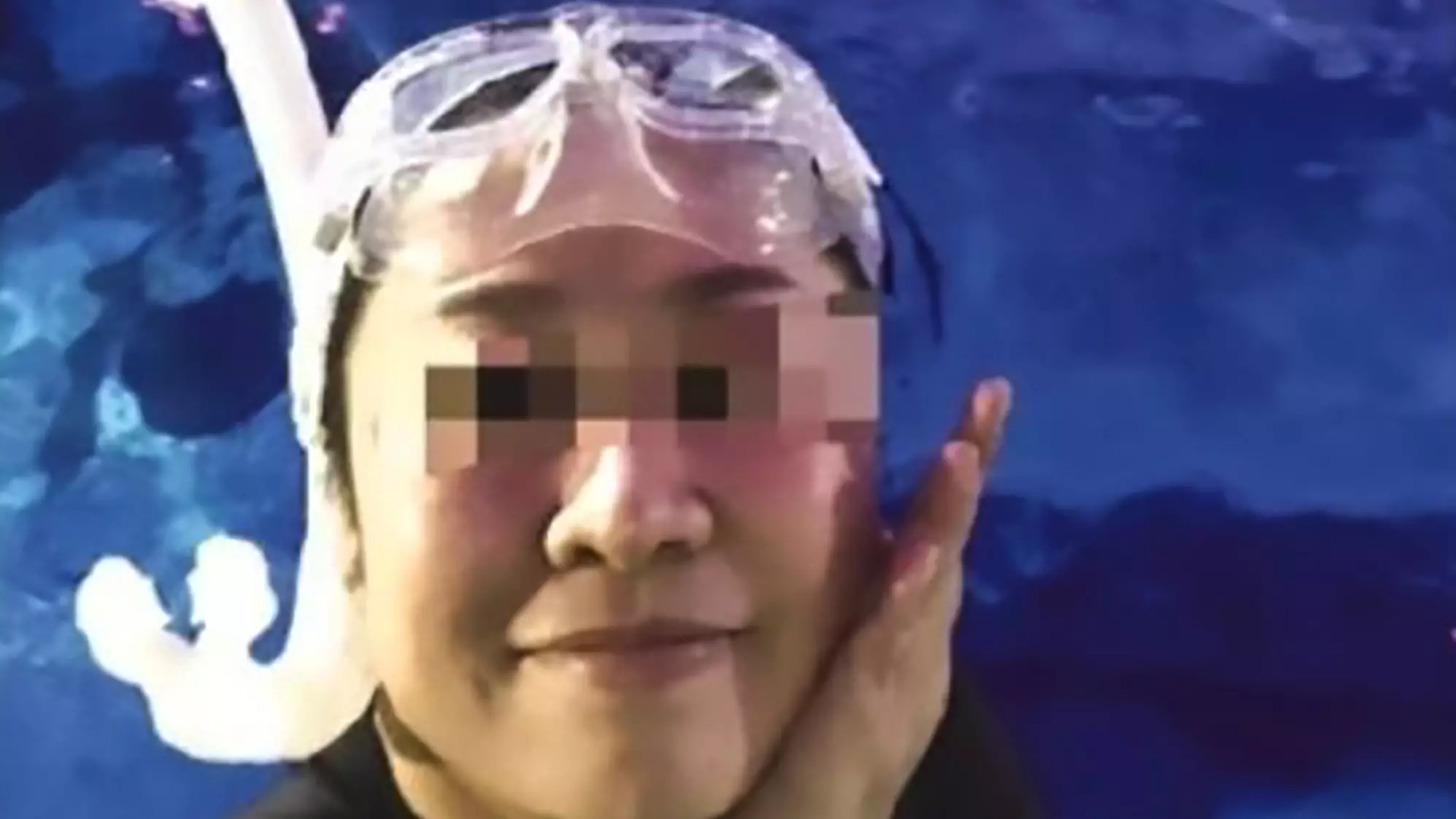 Woman Bitten In Head After Shark Attack During Diving Lesson