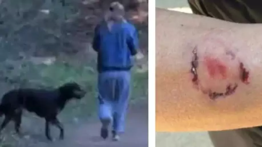 Woman Arrested For Allegedly Biting Jogger Who Pepper-Sprayed Her Dog