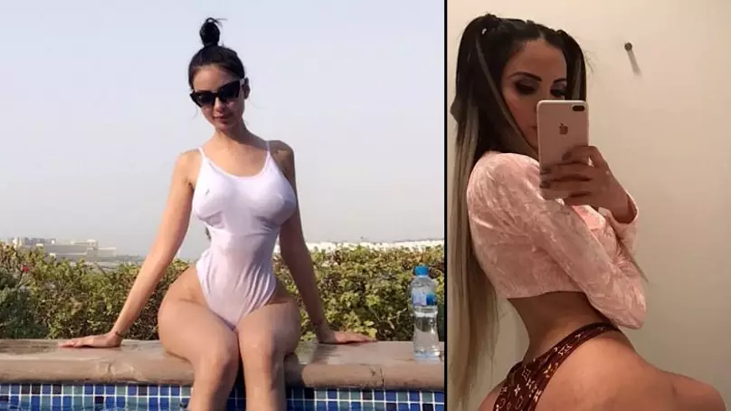 Woman Has Four Pints Of Fat Injected Into Her Bum To Look Like Kim Kardashian