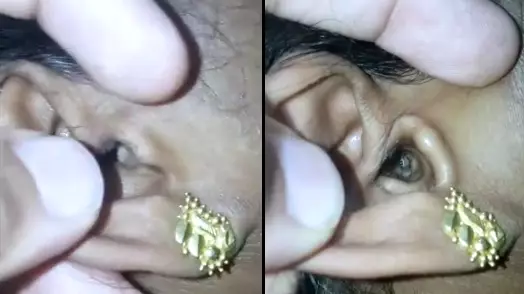 Video Shows Horrific Moment Spider Crawls Out Of Woman's Ear