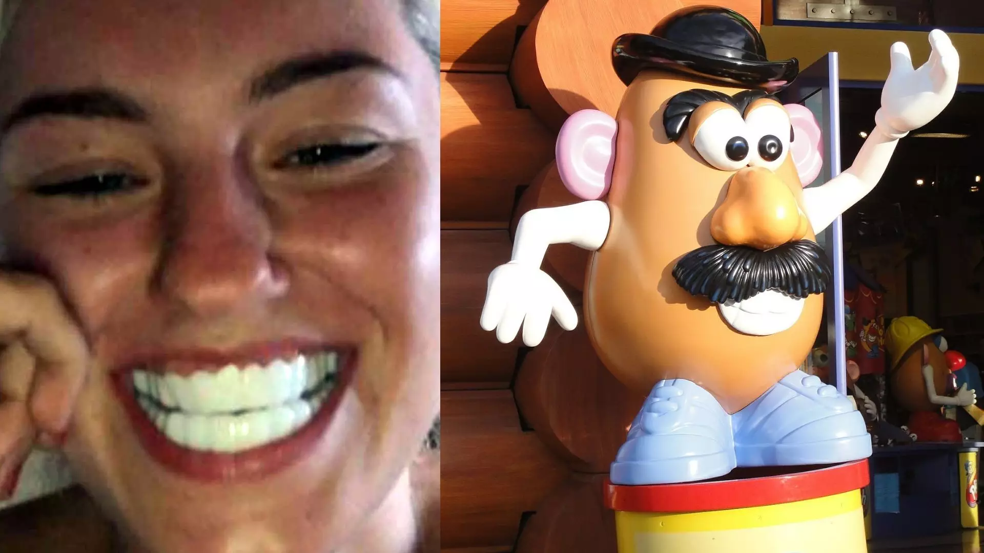 Woman Is Left ‘Looking Like Mr Potato Head’ After Buying Clip-on Veneers For £40