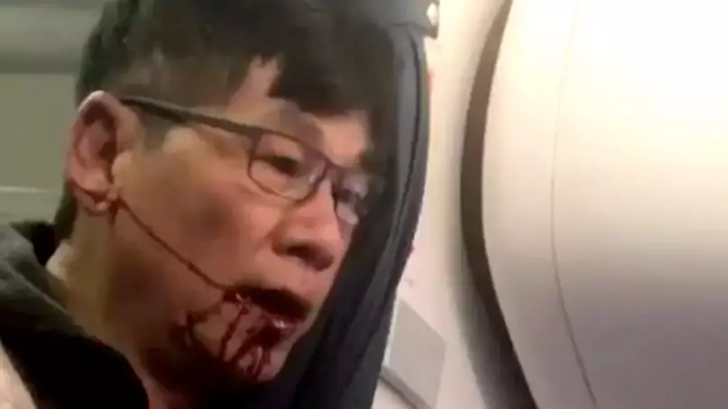 Doctor Dragged Off United Airlines Flight Reveals His Injuries After Settlement 