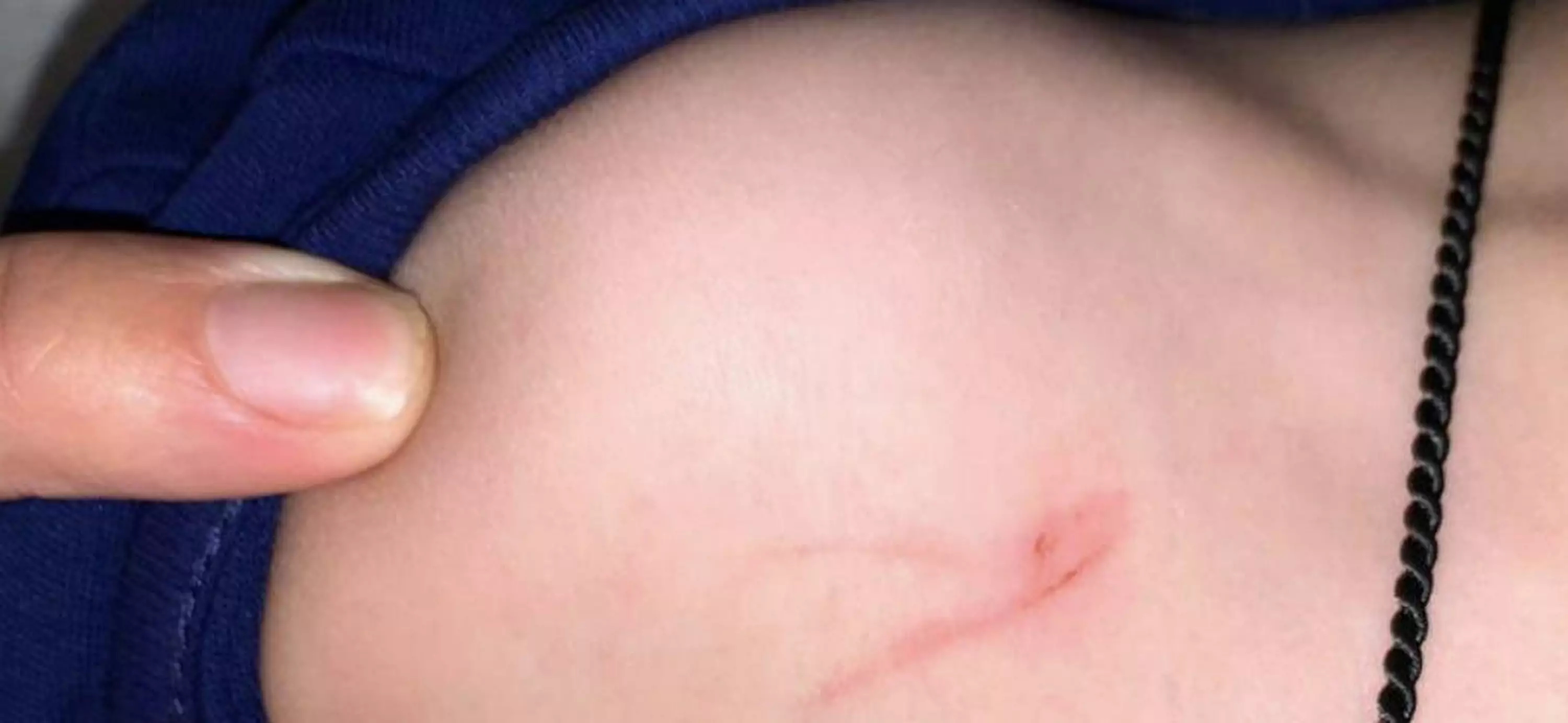 One-year-old Demid suffered scratches and bruises from the baptism.