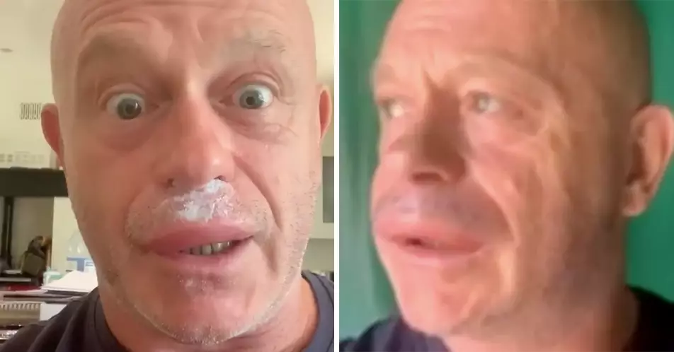 Ross Kemp Reveals Horrifying Swollen Face After Being Attacked By Multiple Wasps