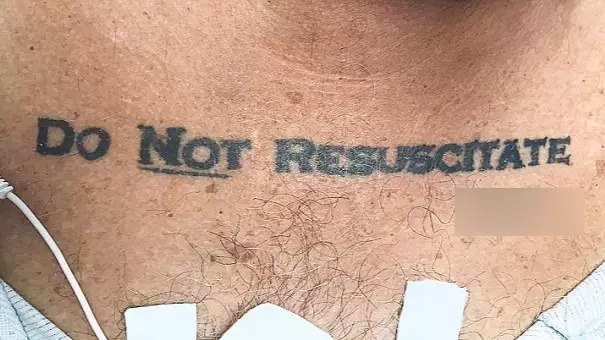 Doctors Stumped By ‘Do Not Resuscitate’ Tattoo On Unconscious Man Brought To Hospital 