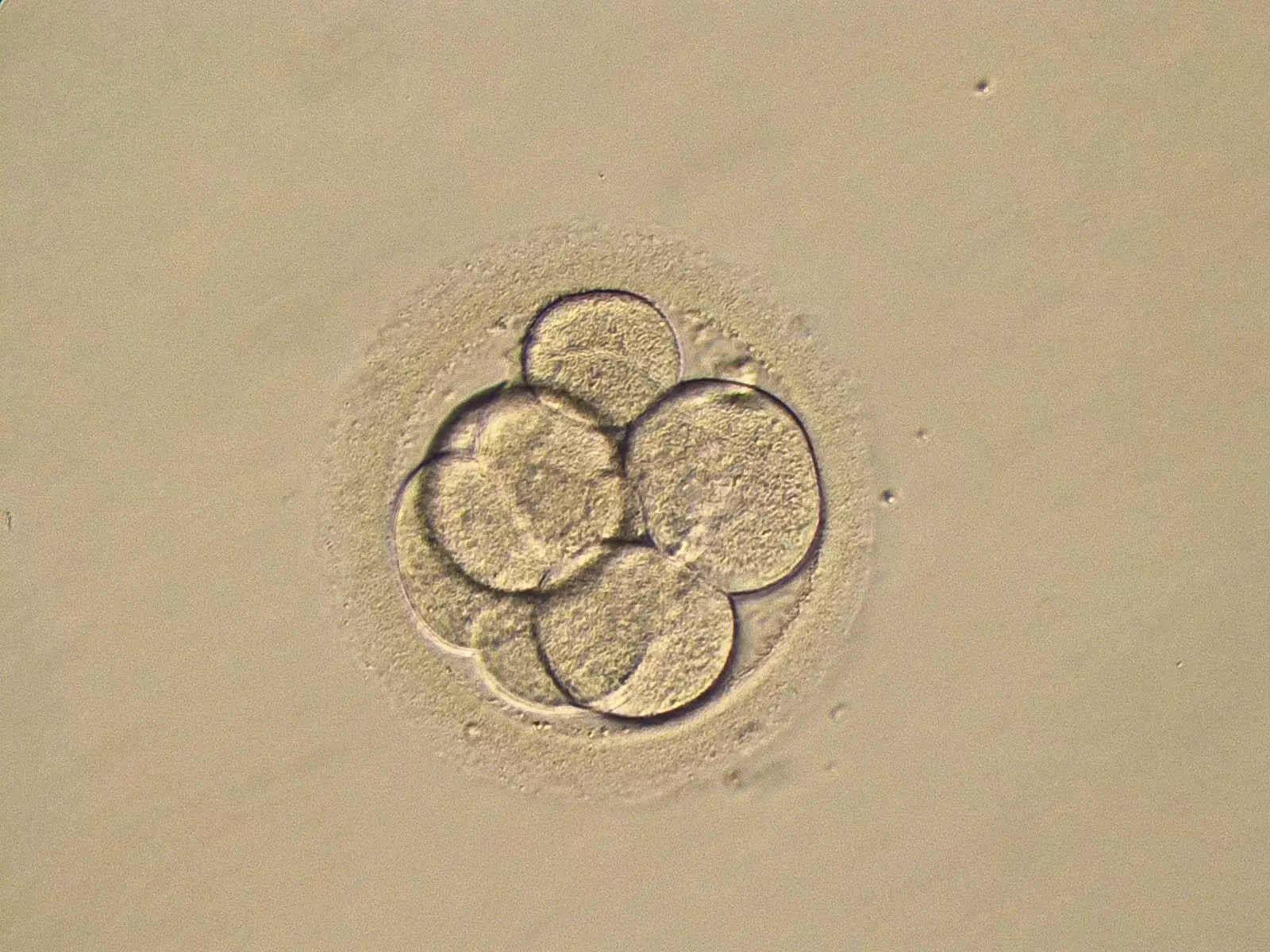 Human embryo.