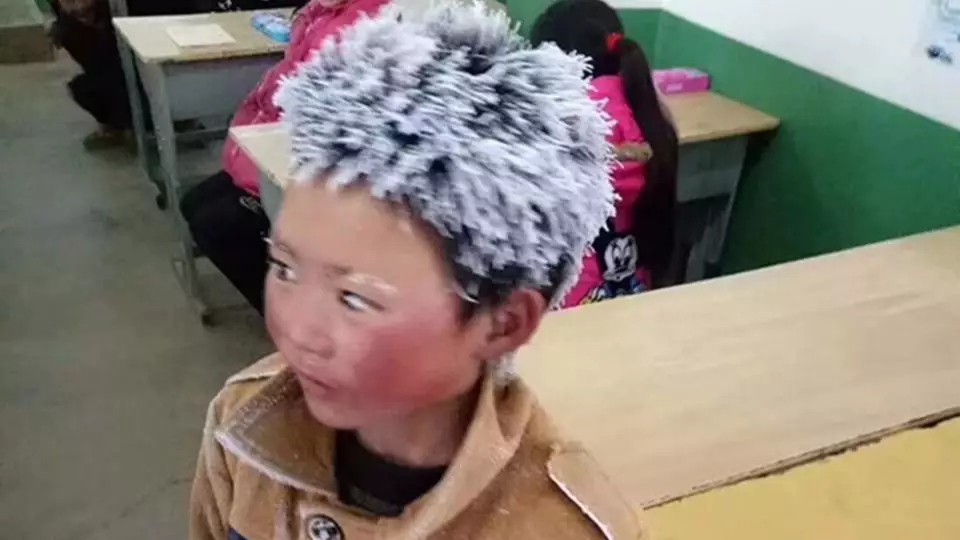 ​£245k Raised For Chinese Boy Whose Hair Froze On Way To School