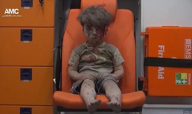 Young Boy Injured In Syrian Airstrikes Has Been Reunited With His Parents