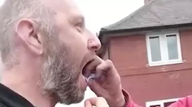 LADs Try Absolutely Everything To Help Pull Out Their Mate's Tooth