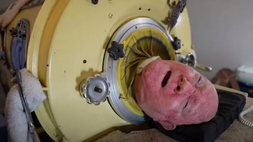 Man Has Been Using Iron Lung Machine For Over 65 Years