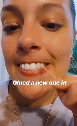 Ashley revealed her teeth were now all fixed (